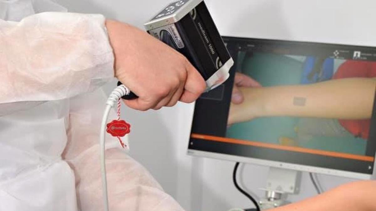 cancer-piele_67977200