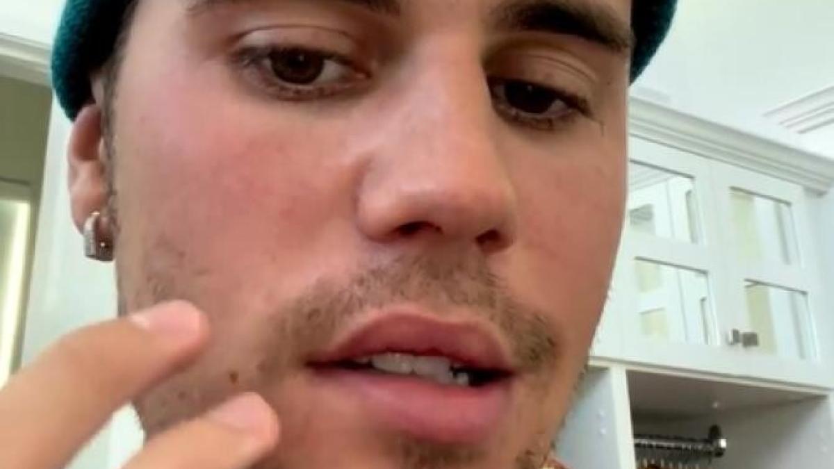 justin-bieber-sufera-de-o-paralizie-care-ii-afecteaza-jumatate-din-fata--si-a-anulat-concertele---video_06797500