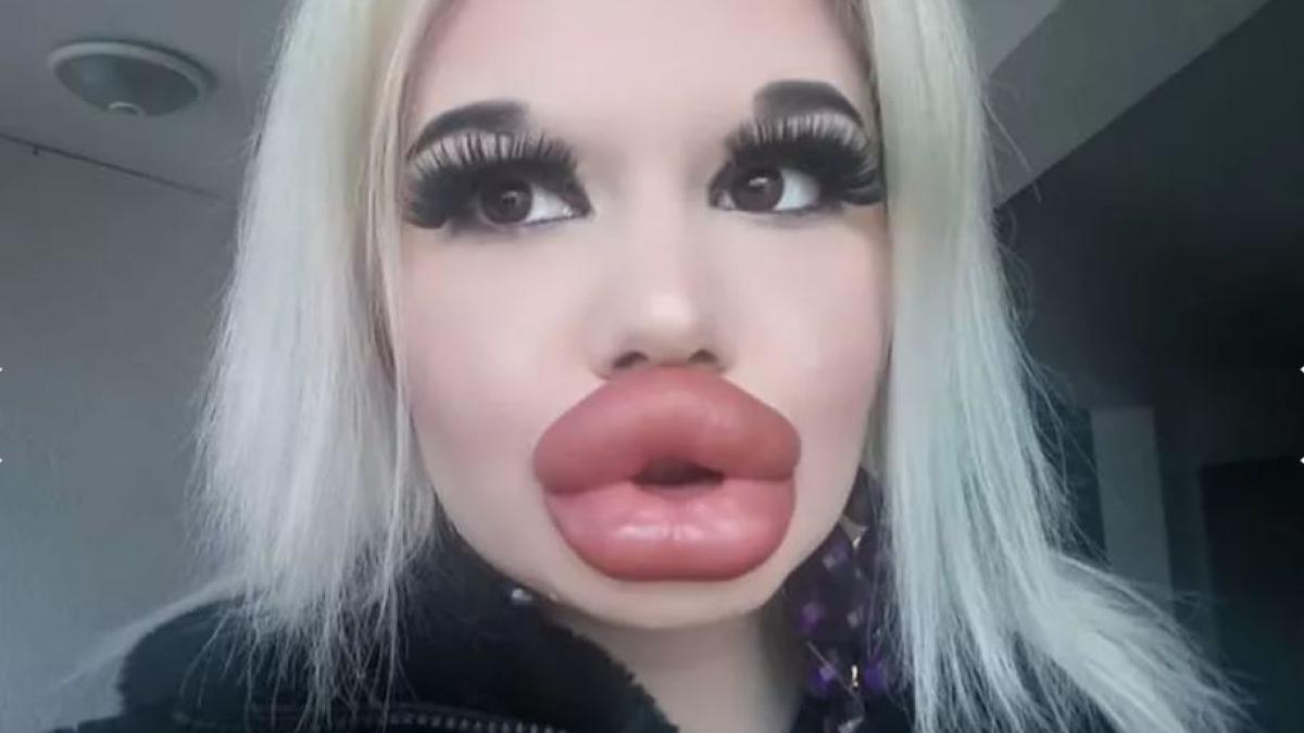 ivanova-femeia-cu-cele-mai-mari-buze_36052700