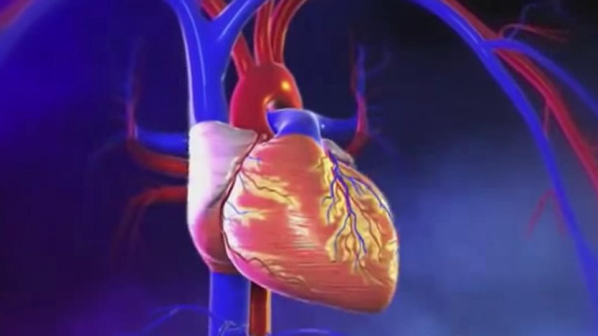 accident-vascular-cerebral_77472200