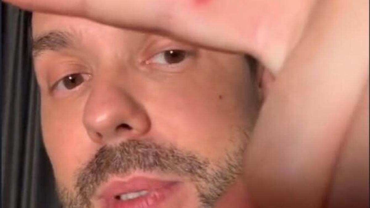 un-blogger-si-designer-de-moda-a-fost-testat-pozitiv-pentru-variola-maimutei_97043900