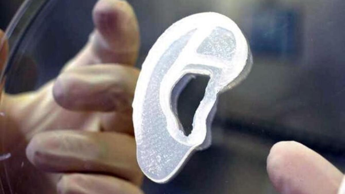 ureche-transplantata_76927900