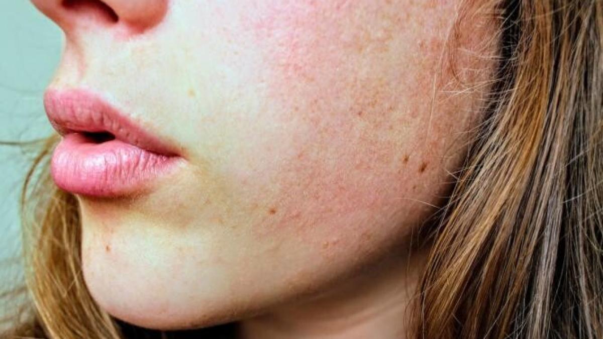 ten_foto_pexels_21046000