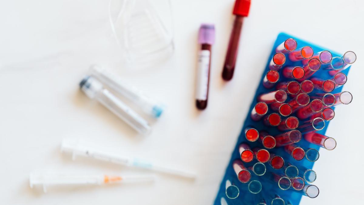 grupa-sanguina-accident-vascular-cerebral_36647800