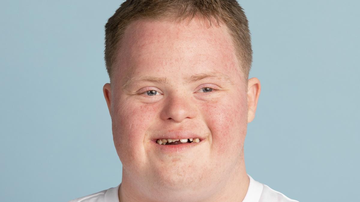 sindrom-down_05288800