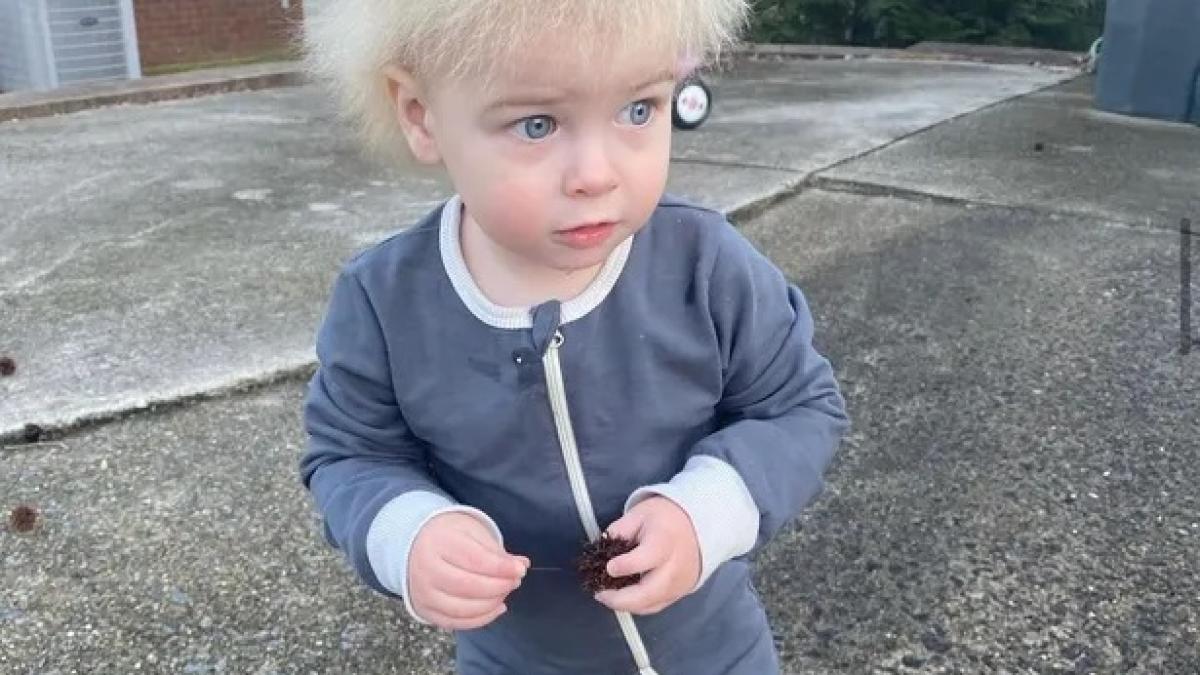 sindrom-par-ciufulit_88119300