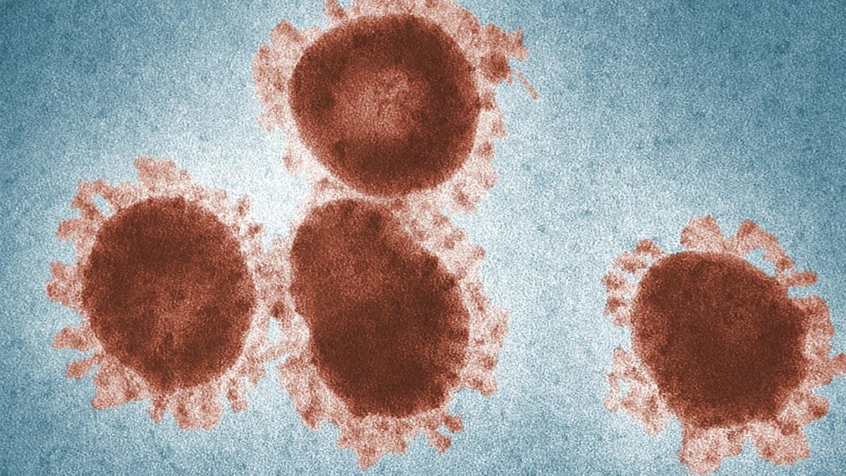 virusul-khosta-2_08430300