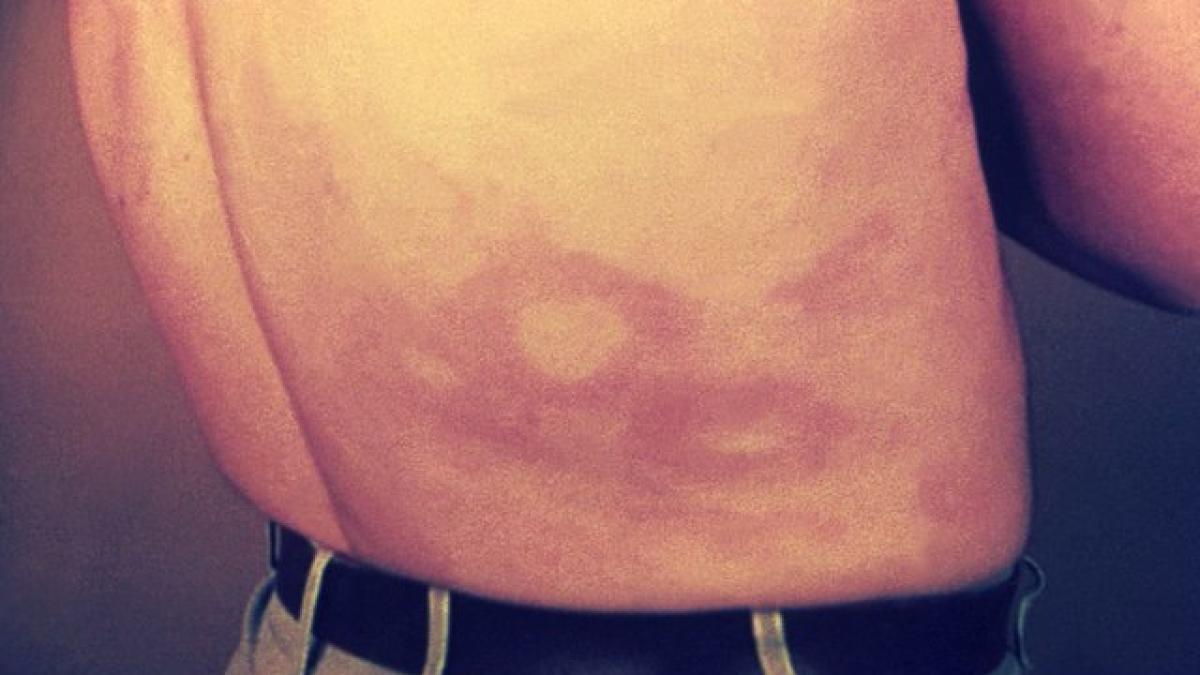 lepra--o-boala-medievala--ar-putea-fi-raspunsul-unor-maladii-actuale_26125700