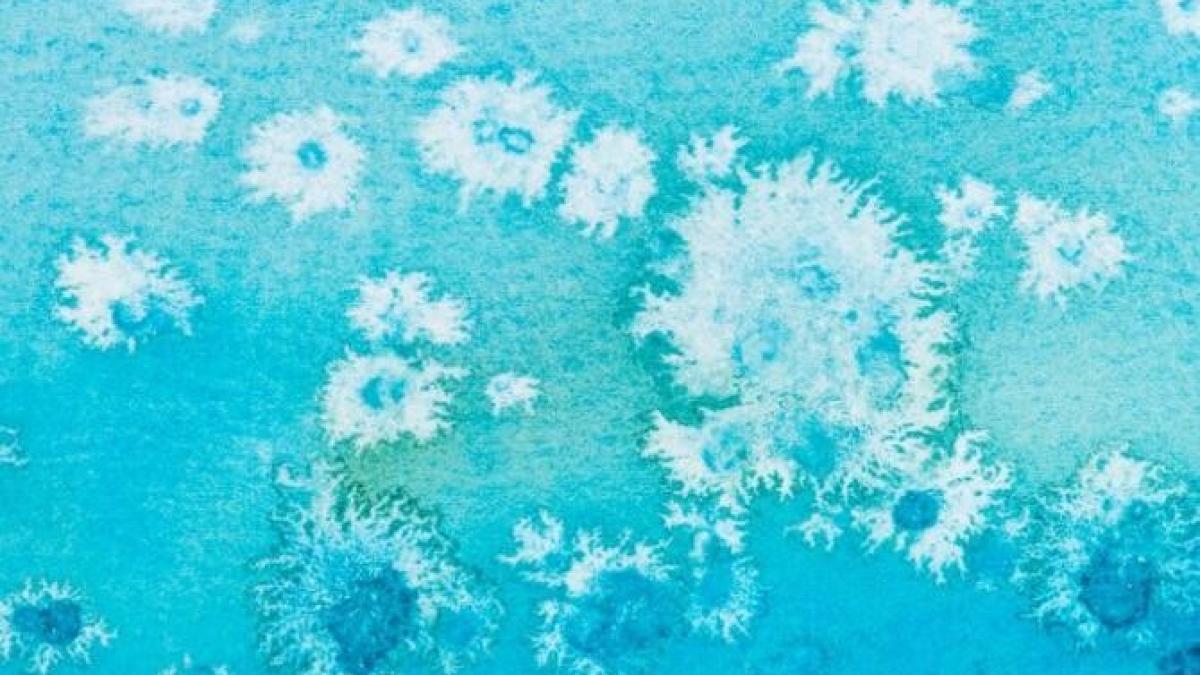 elimina-petele-de-mucegai-de-pe-tesaturi-cu-un-remediu-foarte-usor-si-fara-inalbitor_70608400