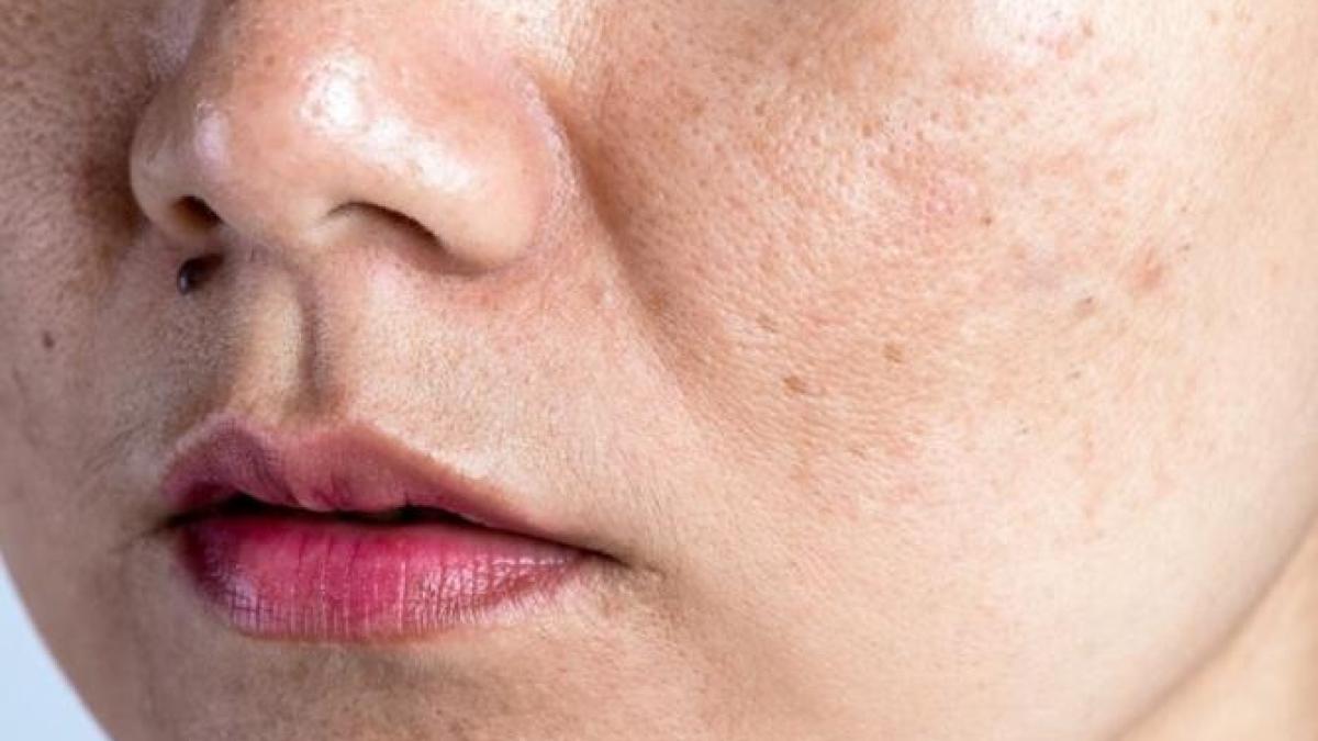 cauzele-imbatranirii-premature-a-pielii-in-timpul-iernii--cum-sa-incetinesti-procesul-si-sa-opresti-schimbarile_72387200