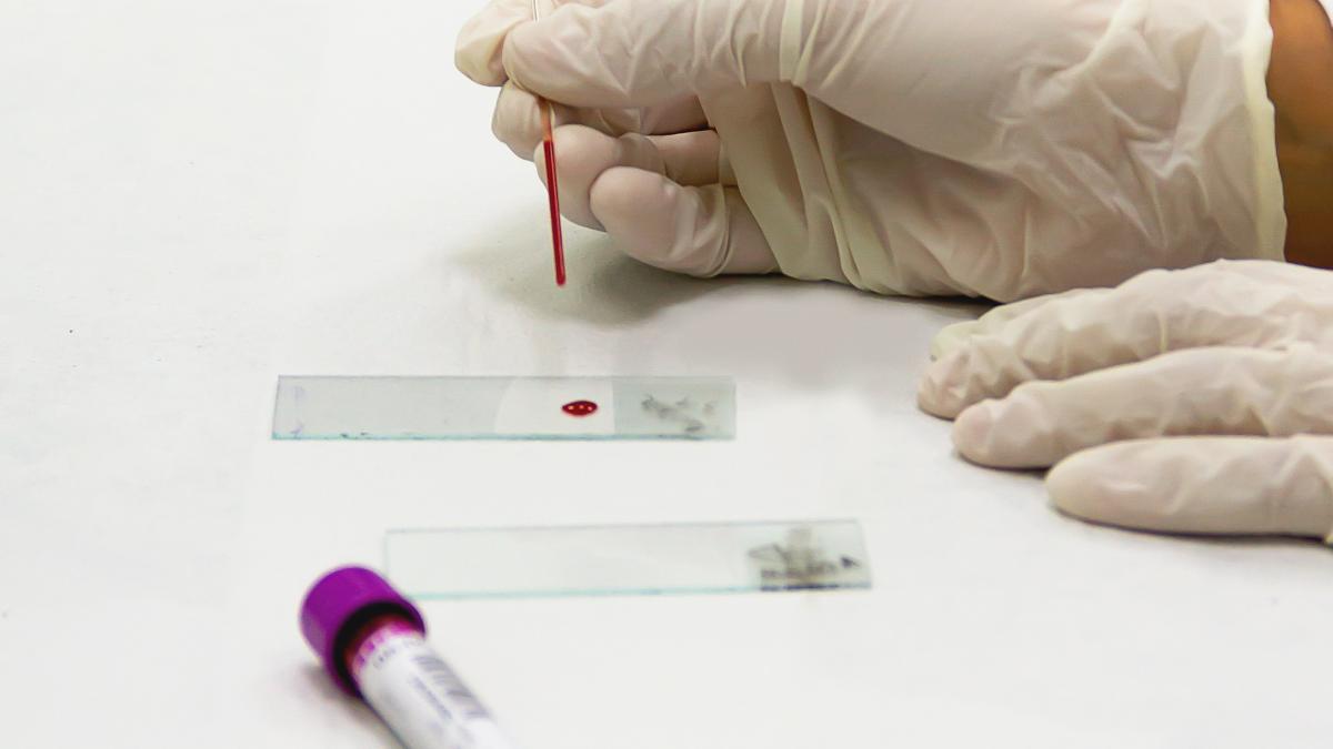 test-de-sange-pentru-diagnosticarea-bolii-alzheimer--rezultat-in-15-minute--de-unde-va-putea-fi-cumparat-kitul-de-diagnosticare_92360100