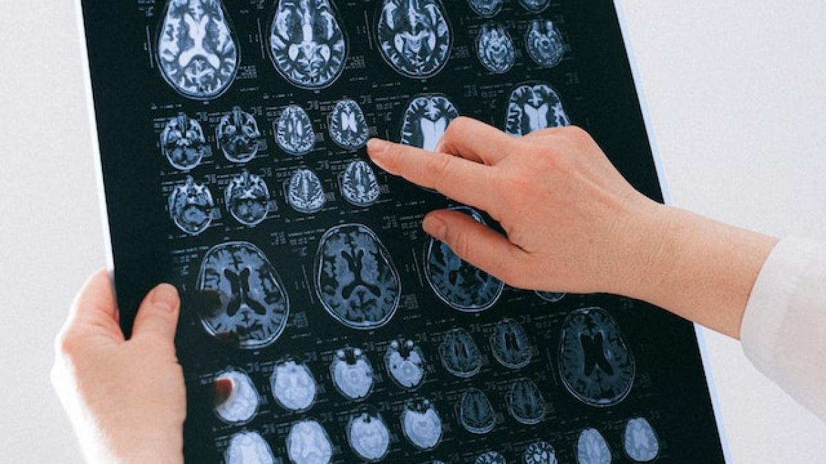 minte-creier-vindecare_48501800