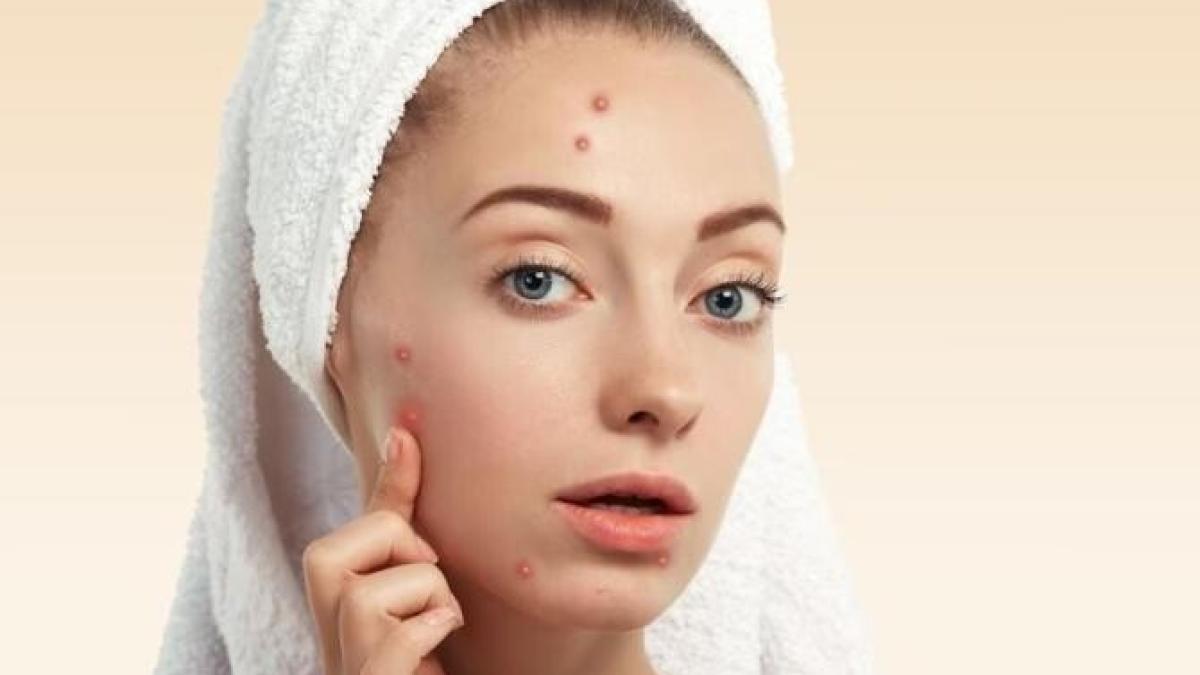 ghimbirul-trateaza-acneea--tonifica--intinereste-si-hraneste-pielea--aflam-cum-il-poti-folosi_39959200