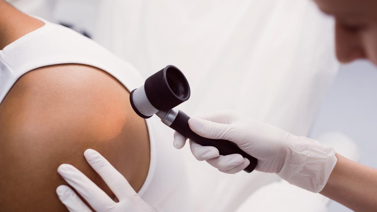 doctor-removing-mole-with-laser-treatment_67090600