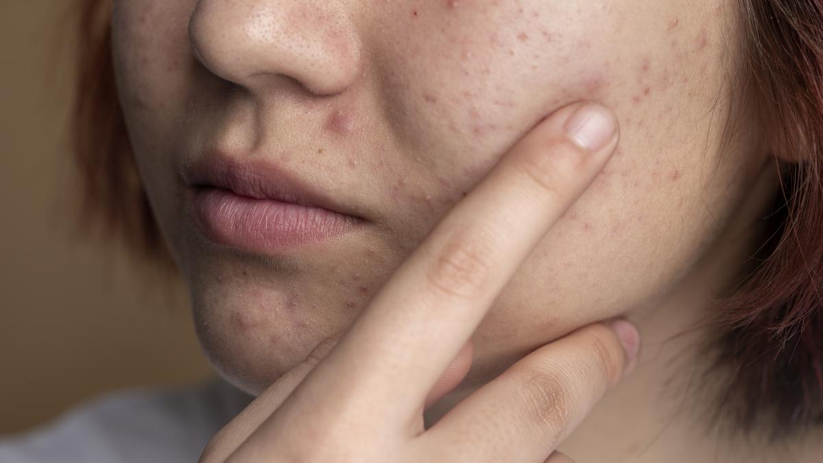 close-up-skin-pores-during-face-care-routine_90290000