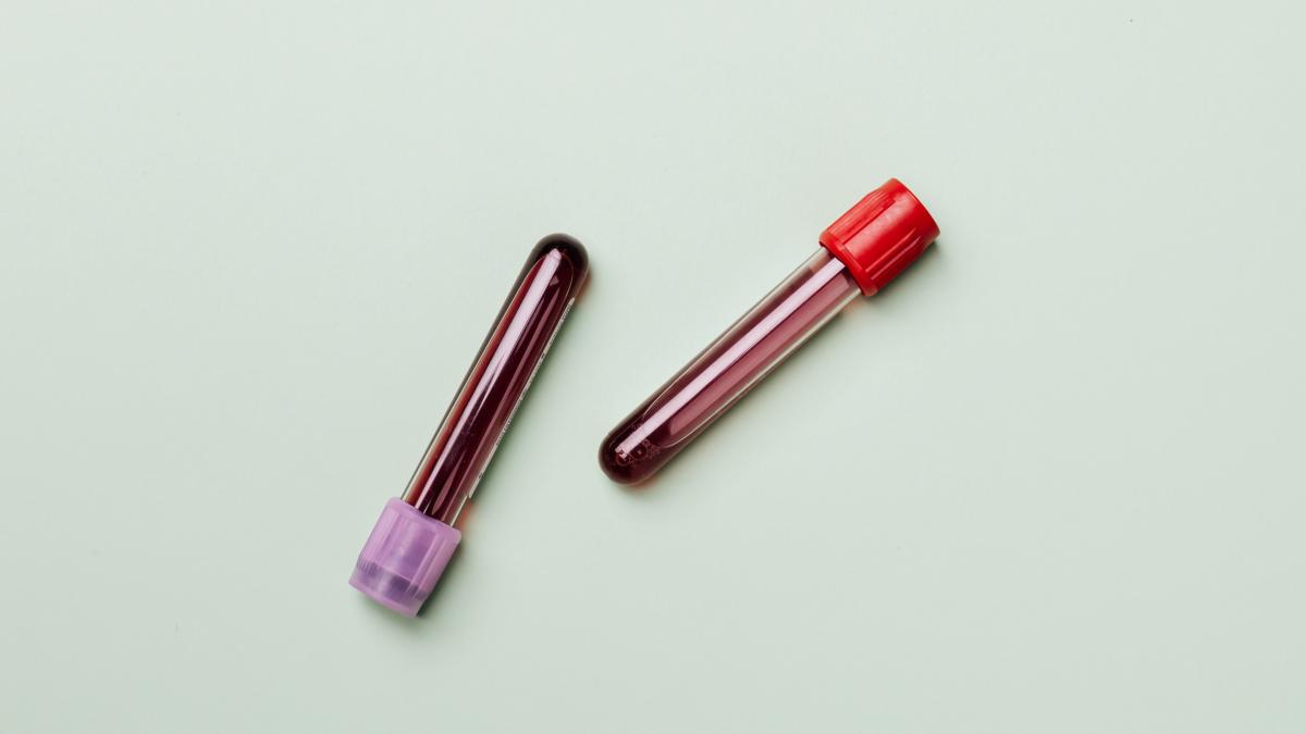 test-de-sange-cancer_29332600