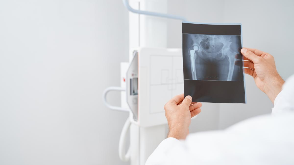 radiografie-bazin_96412700