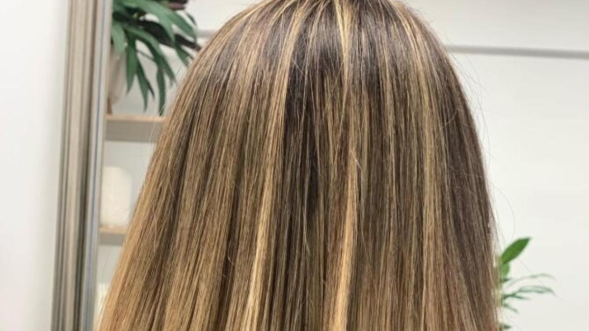 scalp--gras_13967200