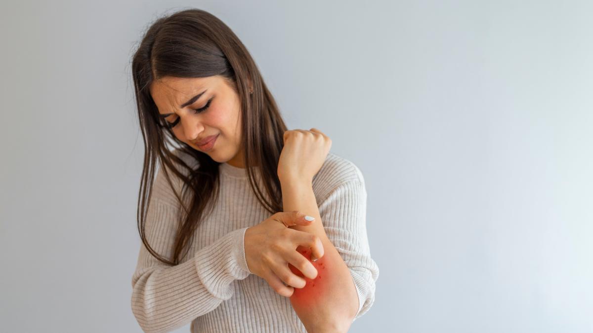 psoriazisul_98416600