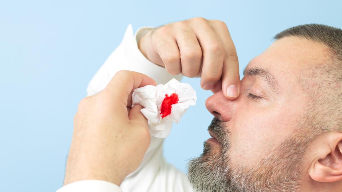 sangerare-din-nas_76866100
