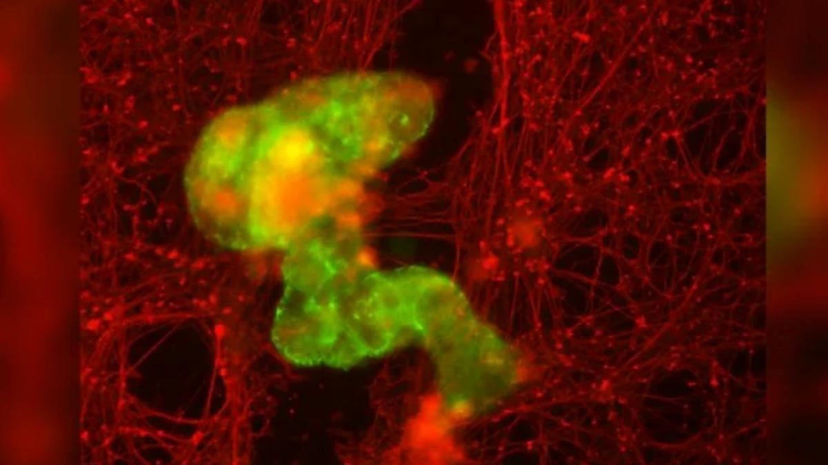 nanoroboti-de-interior_25853500