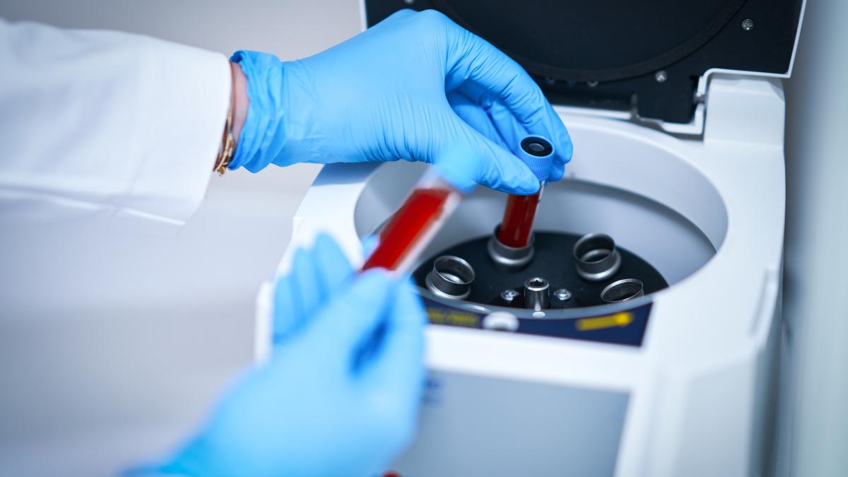 gena-care-poate-creste-riscul-de-cancer-al-sangelui-am-putea-sa-o-depistam-aceasta-in-cadrul-controalelor_18244500