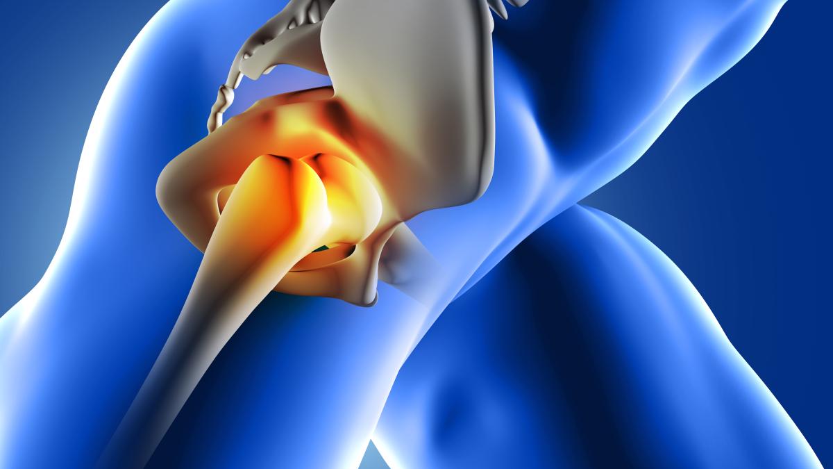 farctura-de-sold_22444500