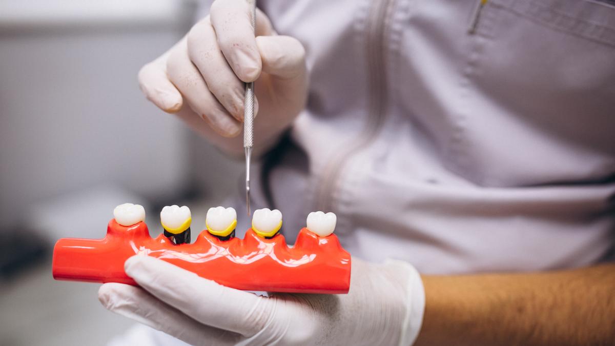 cat-te-costa-un-implant-dentar-in-italia-foarte-scump-in-romania--preturile-nu-sunt-ca-aici_52831000