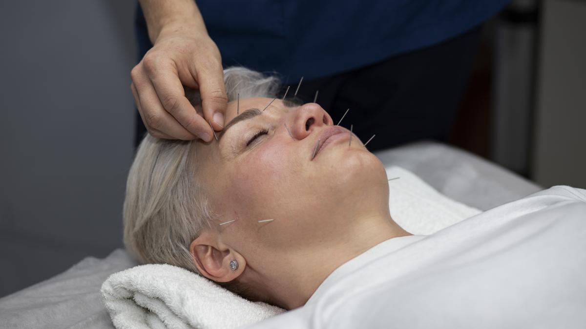 acupunctura-faciala_44975600