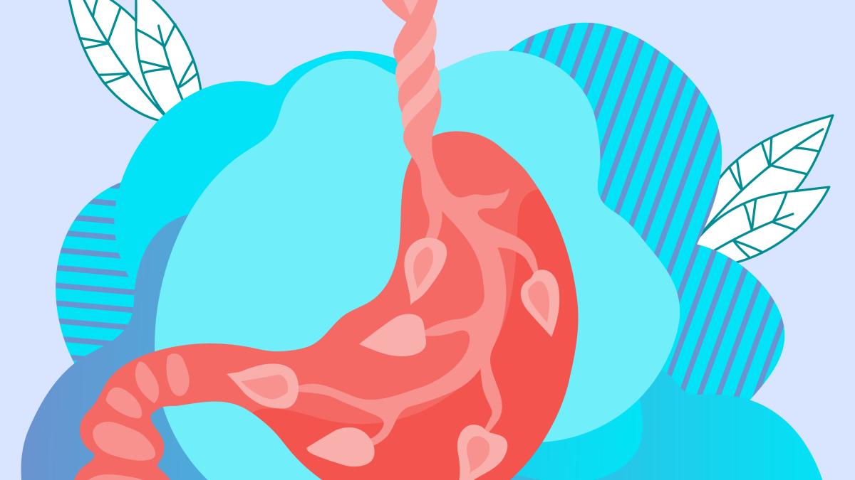 fructele-care-ajuta-digestia--banale--dar-eficiente_75298300