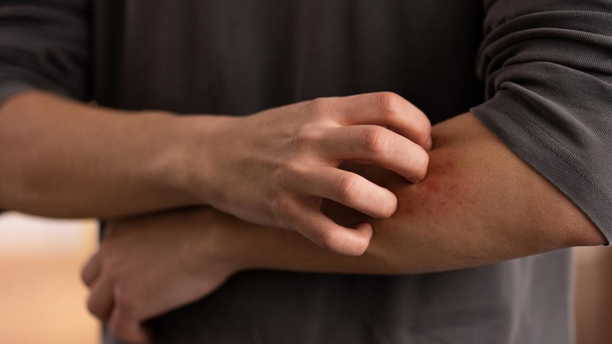 reactii-alergice_54207300