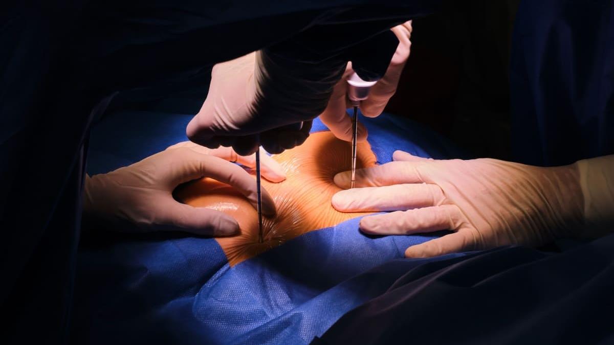 biopsia-de-maduva-osoasa-cand-e-recomandata_09275700