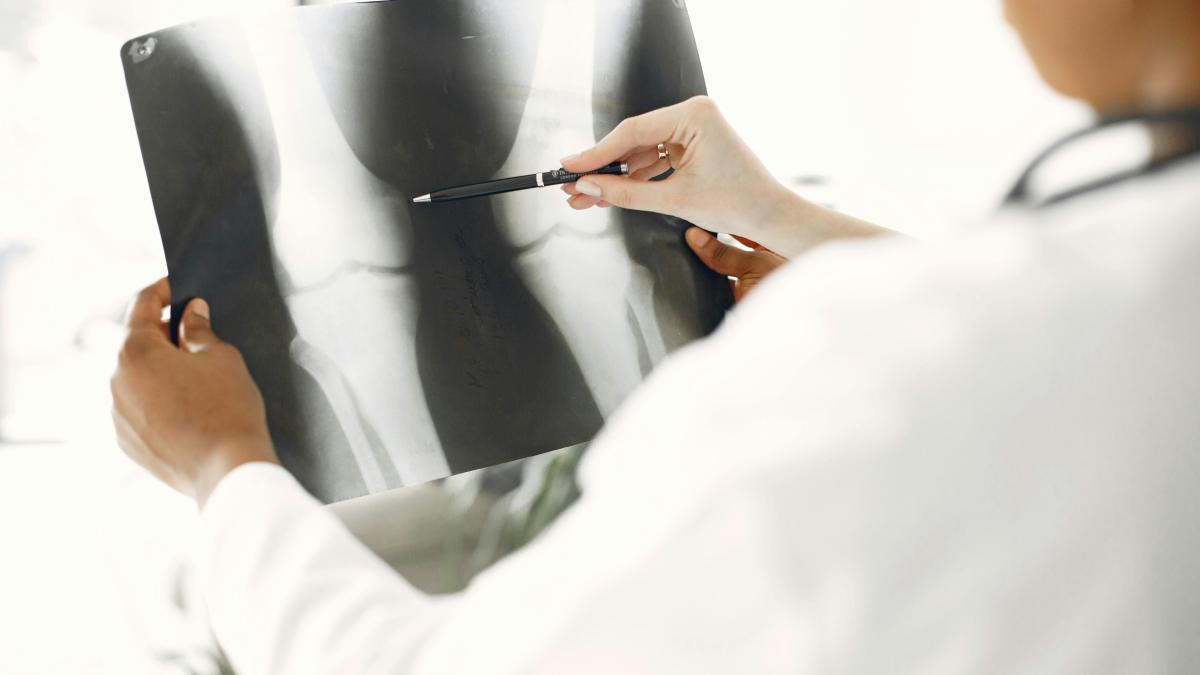 membru-fractura_38485000