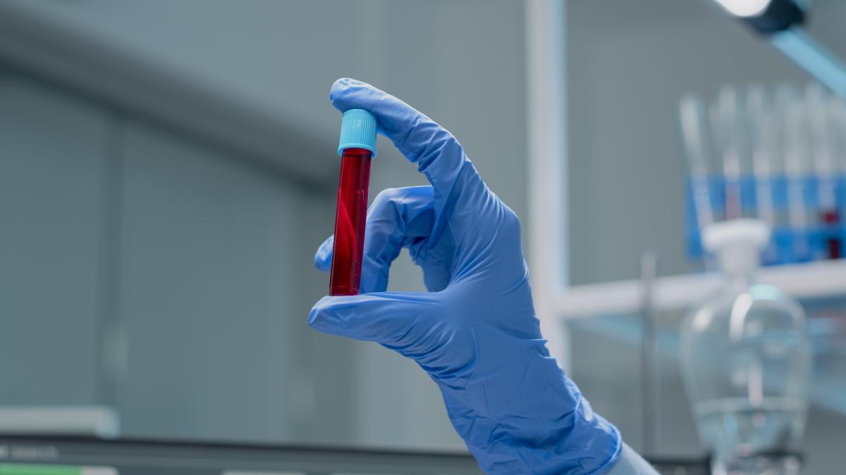 close-up-specialist-hand-with-gloves-holding-vacutainer-with-red-solution-blood-research-laboratory-glass-science-instrument-with-liquid-transparent-beaker-used-innovation_94643600