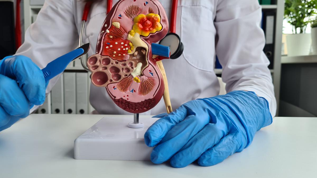 rinichi-doctor_59530100