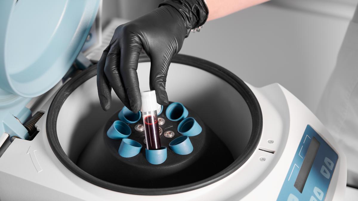 preparation-blood-injections-cosmetologist-puts-tube-blood-centrifuge_85428400