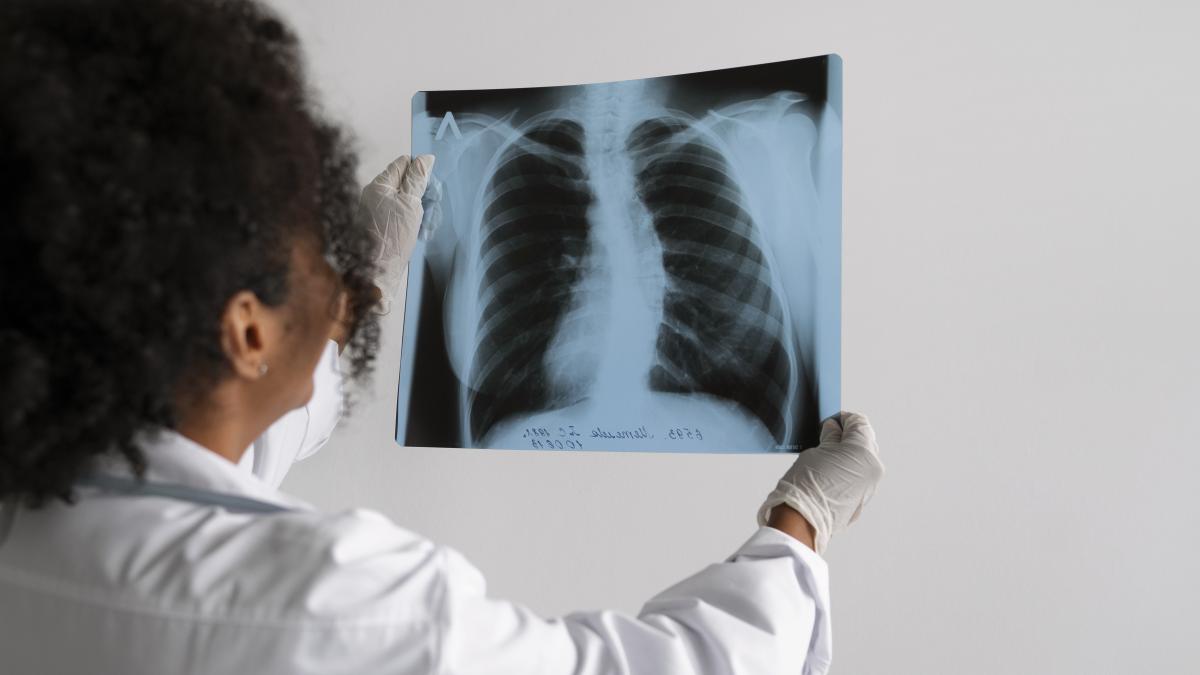 radiografie-plamani-doctor-pneumologie_19112700