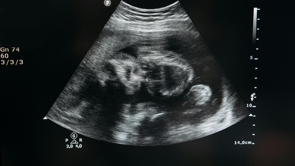 pexels-pavel-danilyuk-7108416