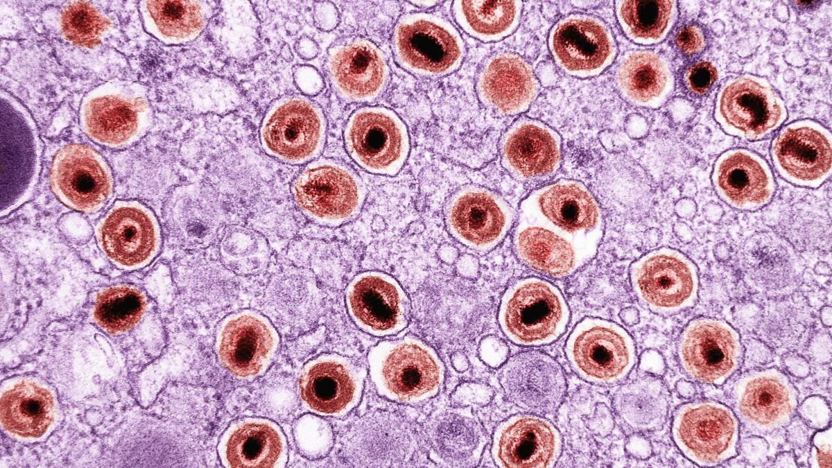 national-institute-of-allergy-and-infectious-diseases-hT57ehNeWk4-unsplash