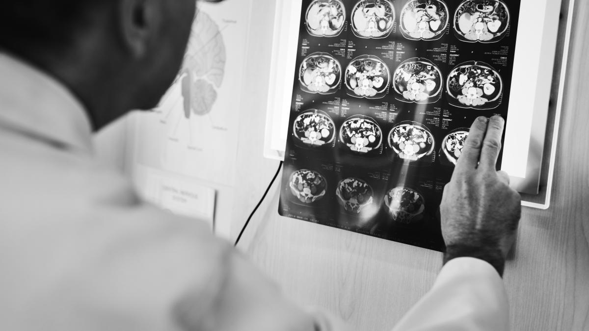 doctor-checking-x-ray-results_47974800