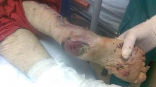 imagini socante cu o femeie internata la spitalul baneasa facute publice de ministrul sanatatii