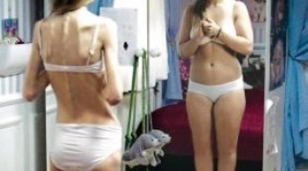 taurii sunt predispusi la anorexie nervoasa sustin cercetatorii britanici