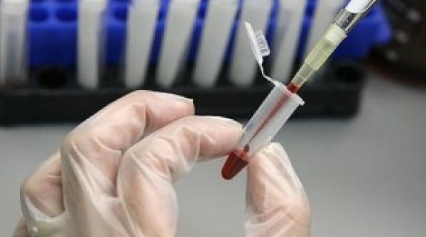 vrei sa stii cat mai ai de trait poti afla cu un test de sange