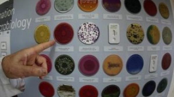 ciuperci daunatoare sanatatii se ascund in aparatele electrocasnice