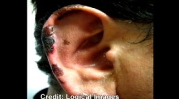 consumatori de droguri atentie cocaina care te mananca de viu a ajuns pe strazi video