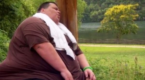 o noua terapie impotriva obezitatii morbide fara interventii chirurgicale