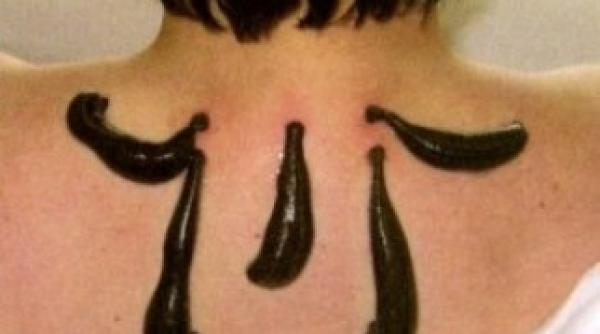 cele mai bizare tratamente de infrumusetare crema de hemoroizi pentru ochi si fixativul pe fata