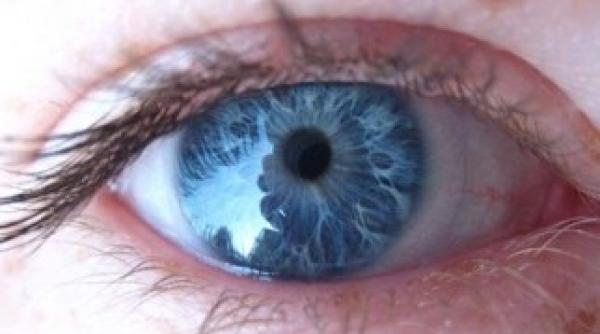 un tratament cu laser transforma definitiv ochii caprui in ochi albastri