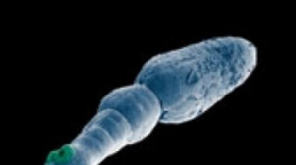 oamenii ar putea trai 500 de ani multumita limbricilor