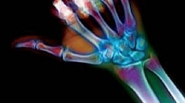 a fost creata imprimanta care realizeaza oase